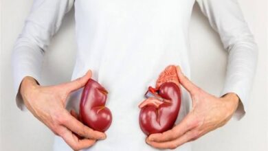 احذر .. 3 عوامل تسهم في تكوين حصوات الكلى