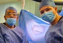 جراحة ناجحة لتركيب جهاز تعويضي لضعف الانتصاب بجامعة كفر الشيخ