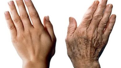 سكر وأنيميا وشلل رعاش.. 21 علامات تظهر على اليد تكشف أمراضا خطيرة