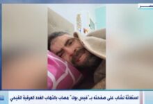 مصاب بالتهاب الغدد العرقية.. الصحة تستجيب لشاب بعد استغاثته عبر فيس بوك