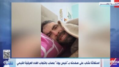 مصاب بالتهاب الغدد العرقية.. الصحة تستجيب لشاب بعد استغاثته عبر فيس بوك